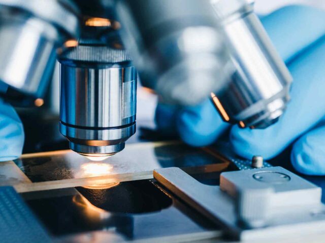 From Glasses to Freedom: Real Patient Journeys Through SMILE Eye Surgery